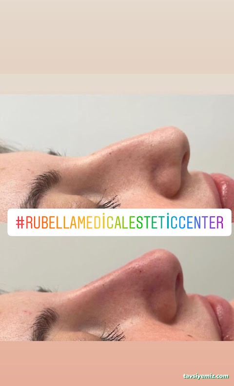 Rubella Medical Estetik Güzellik Ve Sağlık Merkezi Ağrı Rubella Medical Estetik Güzellik Ve Sağlık Merkezi Ağrı