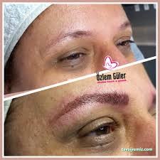 Özlem Güler Estetik Ve Güzellik Merkezi Özlem Güler Estetik Ve Güzellik Merkezi