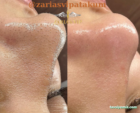 Zaria's Vip Lazer Epilasyon Ve Zayıflama Merkezi Zaria's Vip Lazer Epilasyon Ve Zayıflama Merkezi