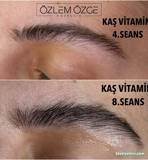 Özlem Özge Güzellik Özlem Özge Güzellik
