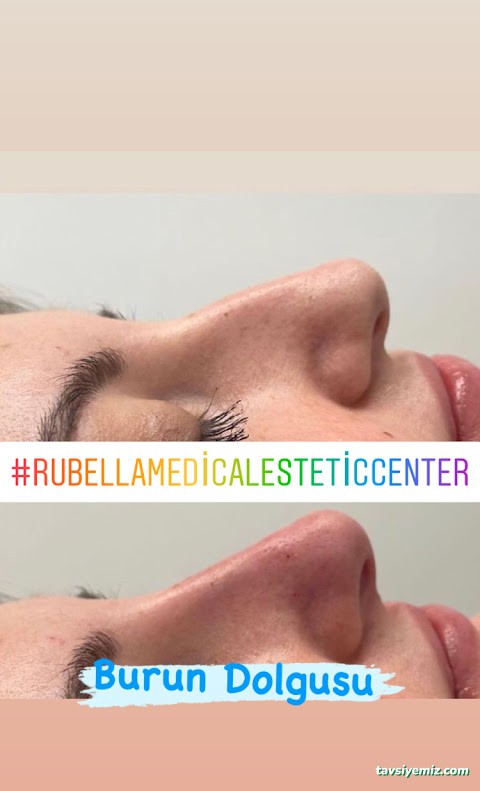 Rubella Medical Estetik Güzellik Ve Sağlık Merkezi Ağrı Rubella Medical Estetik Güzellik Ve Sağlık Merkezi Ağrı