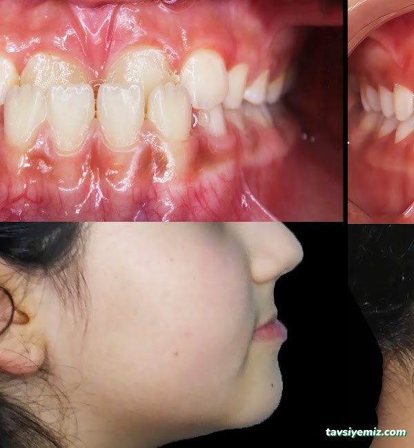 Dr Burak Aksu Ortodonti Uzmanı Dr Burak Aksu Ortodonti Uzmanı