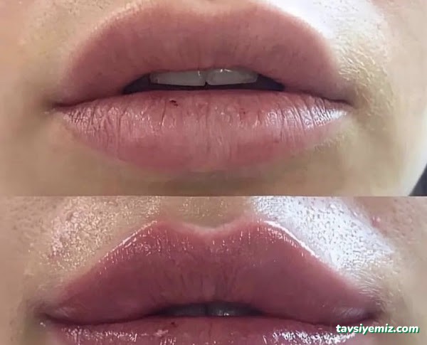 Rubella Medical Estetik Güzellik Ve Sağlık Merkezi Ağrı Rubella Medical Estetik Güzellik Ve Sağlık Merkezi Ağrı
