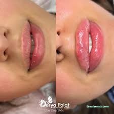 Derya Polat Vip Güzellik&Estetik Derya Polat Vip Güzellik&Estetik