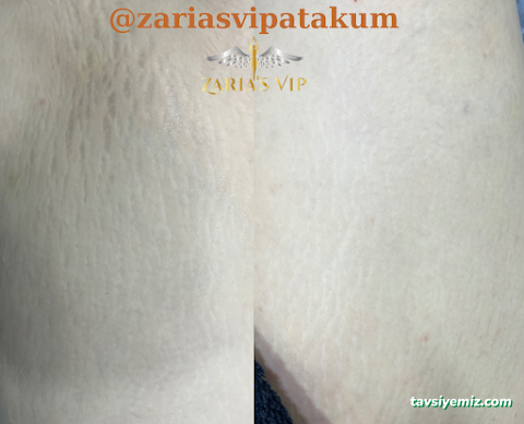 Zaria's Vip Lazer Epilasyon Ve Zayıflama Merkezi Zaria's Vip Lazer Epilasyon Ve Zayıflama Merkezi