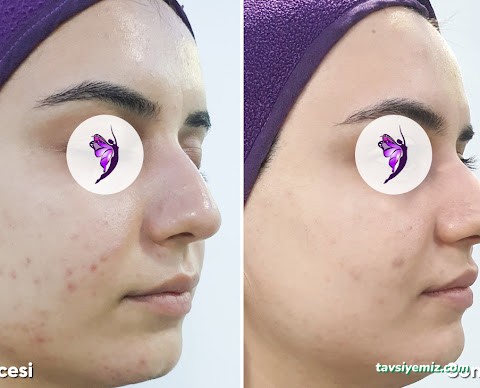 Burcu Zan Güzellik Salonu Burcu Zan Güzellik Salonu