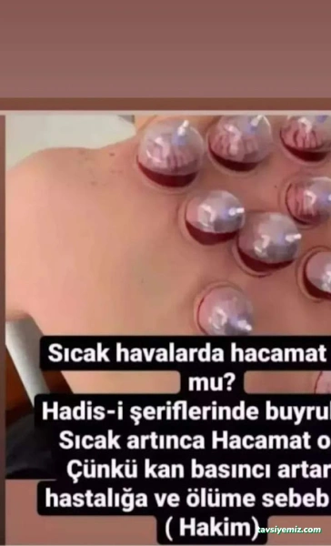 Afyon Hacamat