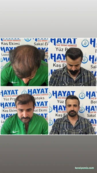 Batman Hayat Saç Ekim&Güzellik Merkezi Batman Hayat Saç Ekim&Güzellik Merkezi