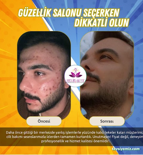 Helin Aluz Güzellik Merkezi Helin Aluz Güzellik Merkezi