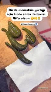 Bitlis Sülük İle Tedavi Merkezi Bitlis Sülük İle Tedavi Merkezi