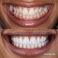 Dr.smile