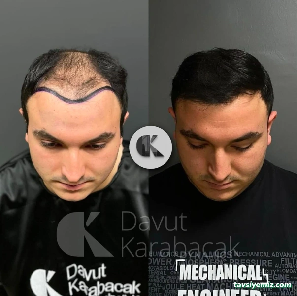 Davut Karabacak Saç Ekim Merkezi Davut Karabacak Saç Ekim Merkezi