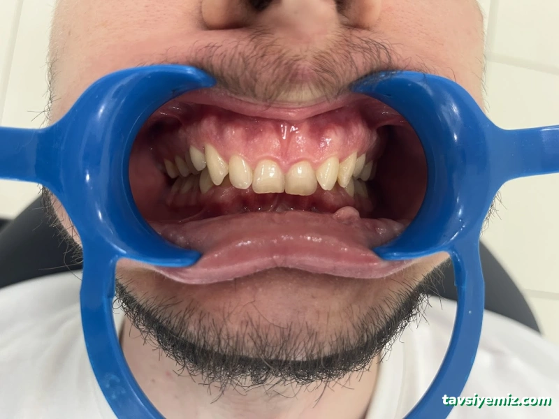 Dentriva Diş Yahyakaptan – İzmit Dentriva Diş Yahyakaptan – İzmit