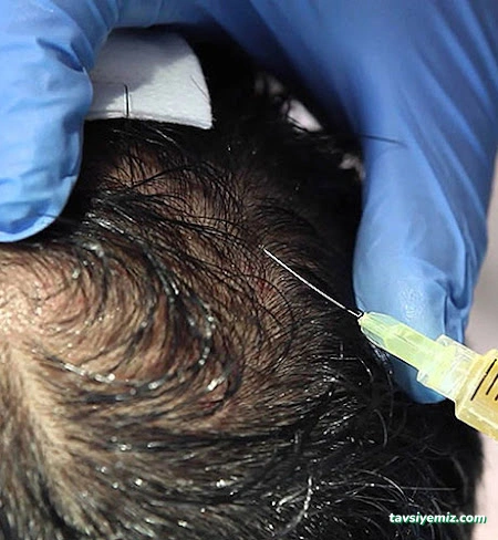 Dr. Bulut Demirci Geleneksel Ve Tamamlayıcı Tıp Ünitesi Dr. Bulut Demirci Geleneksel Ve Tamamlayıcı Tıp Ünitesi