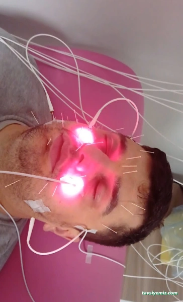 Dr. Nilgün Özönder-Akupunktur Dr. Nilgün Özönder-Akupunktur