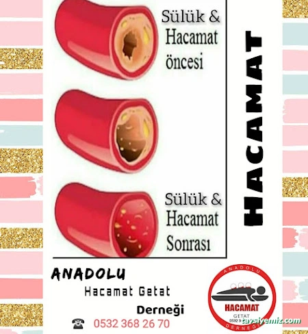 Elazığ Anadolu Hacamat Getat Derneği Elazığ Anadolu Hacamat Getat Derneği