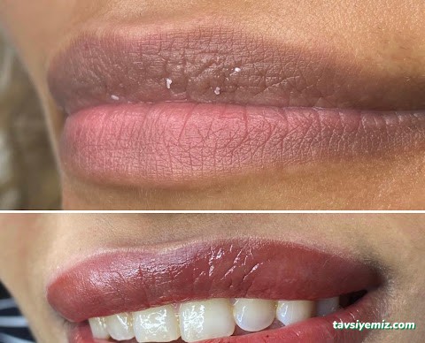 Estedermal Sivas Güzellik Salonu Estedermal Sivas Güzellik Salonu
