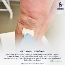 Fizyobolu Fizyoterapi, Manuel Terapi Danışmanlık Fizyobolu Fizyoterapi, Manuel Terapi Danışmanlık