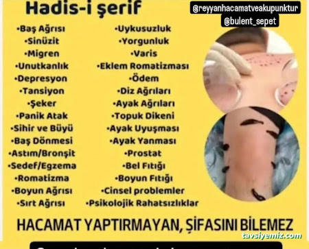 Gaziantep Reyyan Hacamat Ve Akupunktur Gaziantep Reyyan Hacamat Ve Akupunktur