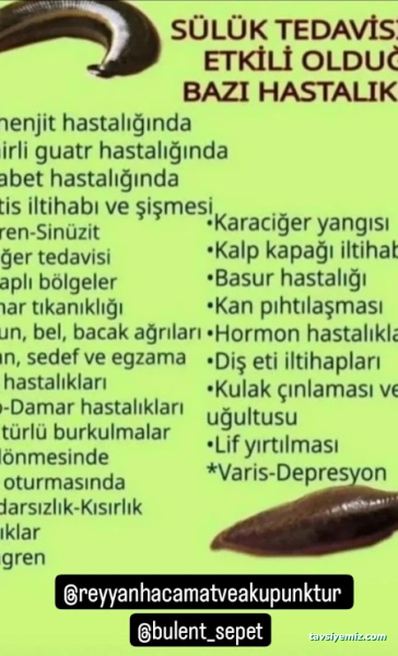 Gaziantep Reyyan Hacamat Ve Akupunktur Gaziantep Reyyan Hacamat Ve Akupunktur