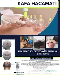 Hacamat Antalya Hacamat Antalya