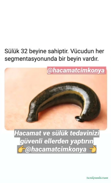 Hacamatcım Konya (Hacamat Konya) Hacamatcım Konya (Hacamat Konya)