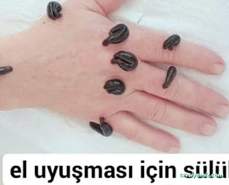 Hacamatcım Konya (Hacamat Konya) Hacamatcım Konya (Hacamat Konya)