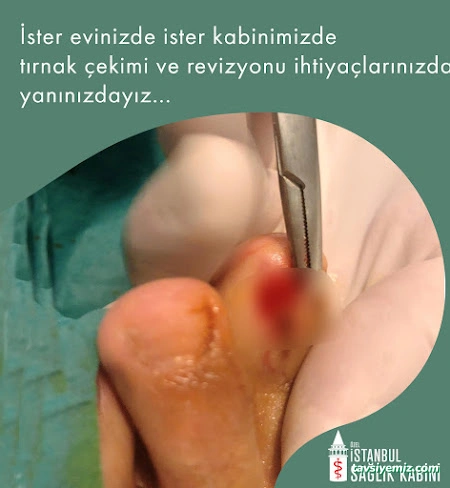 İstanbul Sağlık Kabini İstanbul Sağlık Kabini