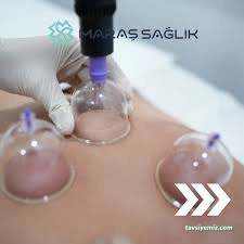 Muş Doğal Terapi Merkezi Muş Doğal Terapi Merkezi