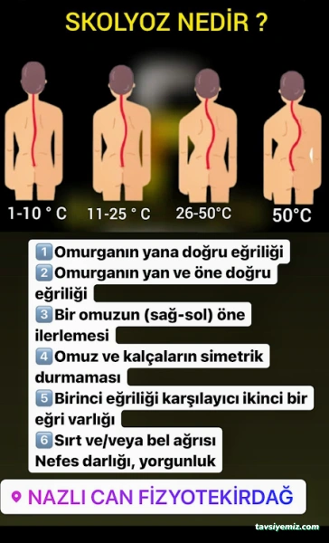Nazlı Can Fizyotekirdağ Nazlı Can Fizyotekirdağ