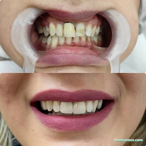 Özel Dental House Ağız Ve Diş Sağlığı Polikliniği Özel Dental House Ağız Ve Diş Sağlığı Polikliniği