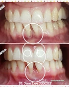 Özel Dental House Ağız Ve Diş Sağlığı Polikliniği Özel Dental House Ağız Ve Diş Sağlığı Polikliniği