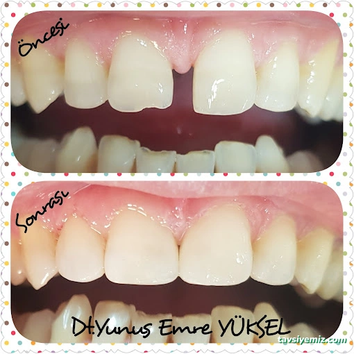 Özel Dental House Ağız Ve Diş Sağlığı Polikliniği Özel Dental House Ağız Ve Diş Sağlığı Polikliniği