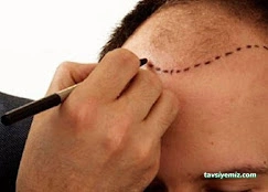 Rize Saç Ekim Merkezi - Hair Clinic Rize Saç Ekim Merkezi - Hair Clinic