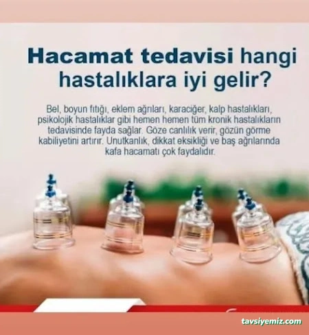 Samsun Hacamat Şifahane (Shiffa Home)