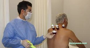 Uzm. Dr. Özgür Sinan Cengiz, Akupunktur Uzm. Dr. Özgür Sinan Cengiz, Akupunktur