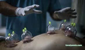 Yenimahalle Hacamat Tedavisi Yenimahalle Hacamat Tedavisi